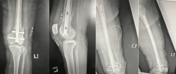 Figure 13