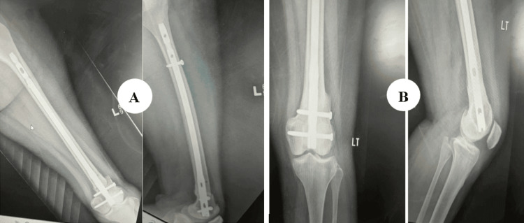 Figure 14