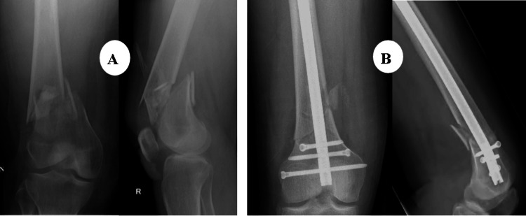Figure 15