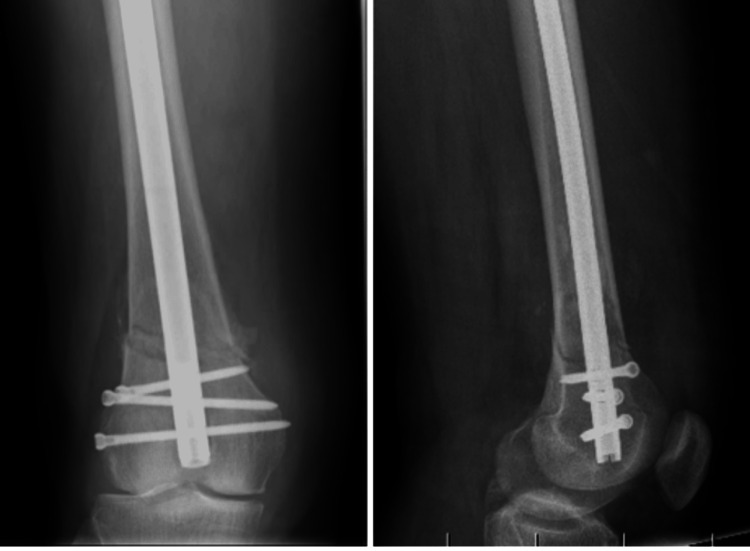 Figure 16