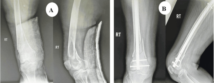Figure 18