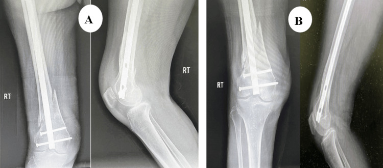 Figure 19