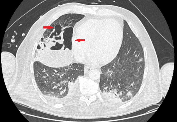 Figure 9