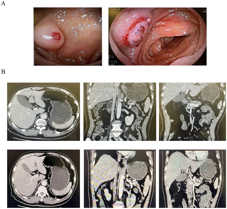 Figure 1