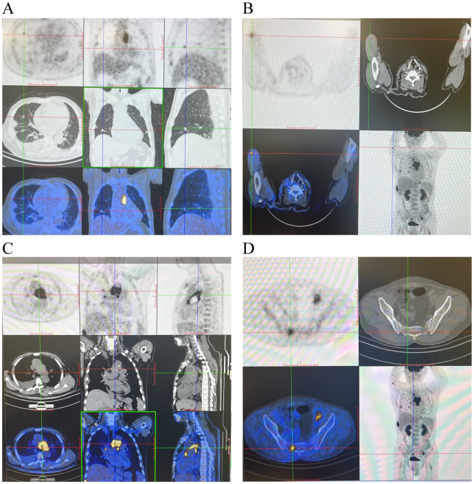 Figure 2