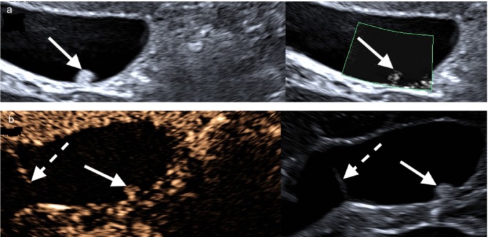 FIGURE 3