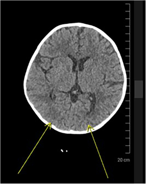 Figure 3