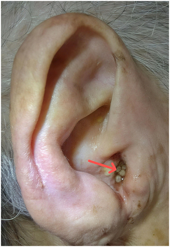 Figure 1
