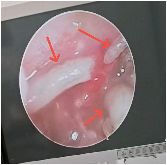 Figure 2