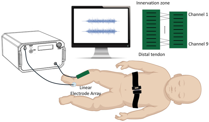 Figure 1