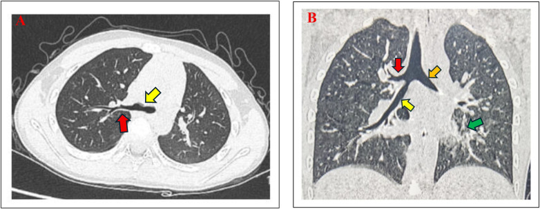 Figure 1