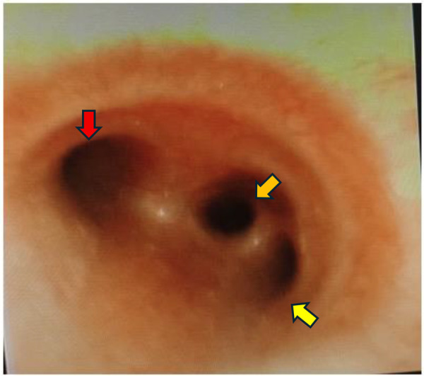Figure 2