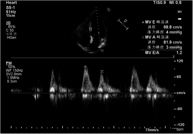 Figure 1