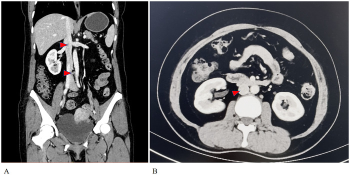 Figure 2