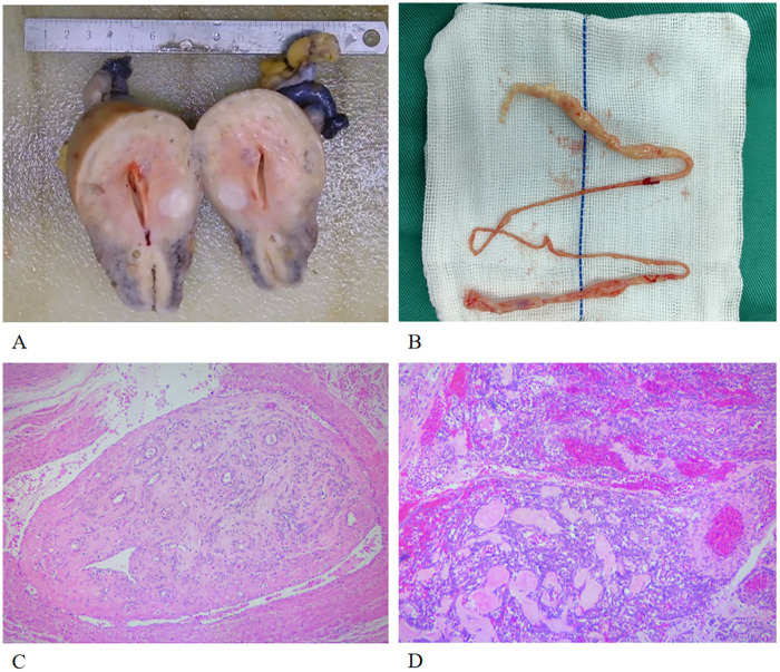 Figure 3