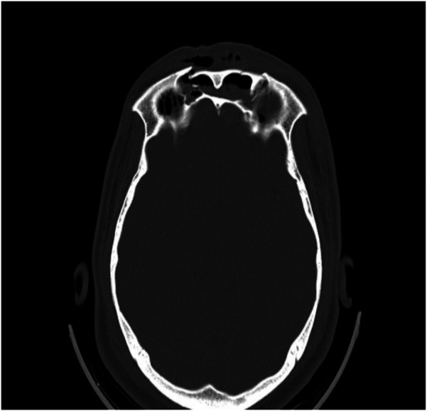 Figure 2