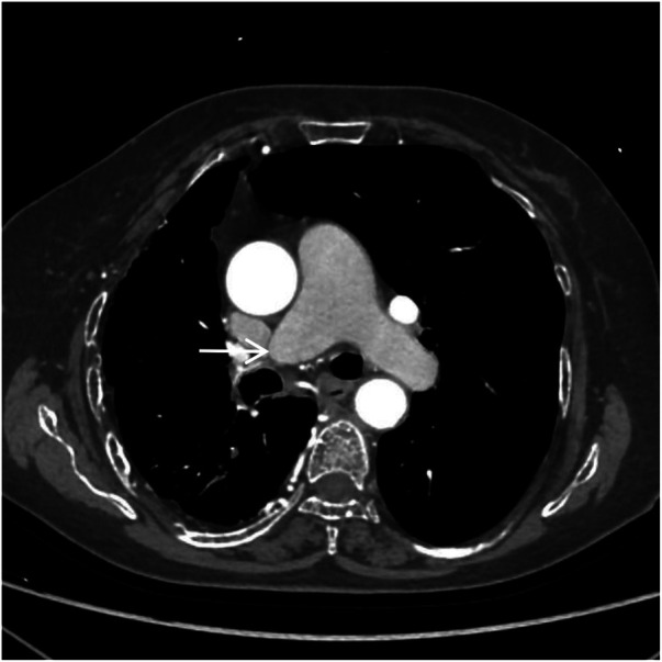 Figure 2