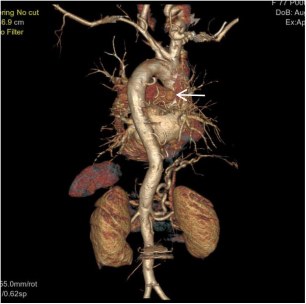 Figure 6