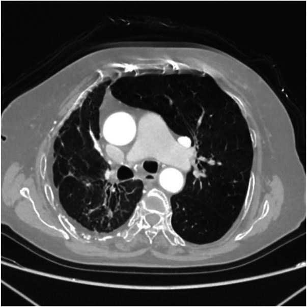 Figure 11