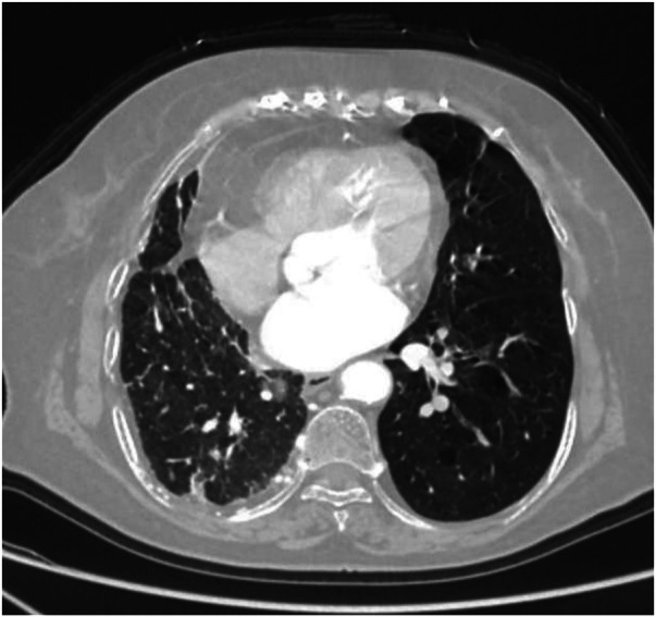 Figure 12