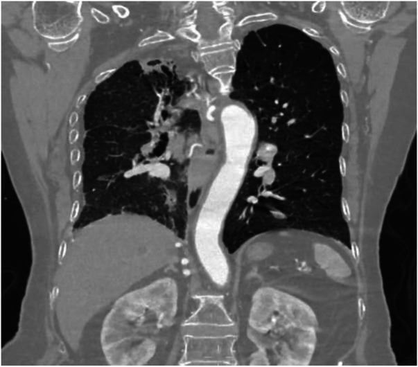 Figure 13