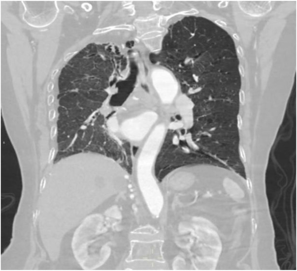Figure 14