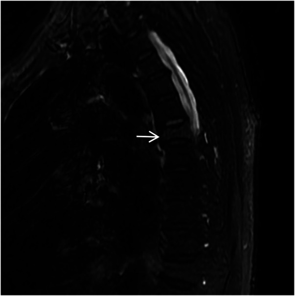 Figure 16