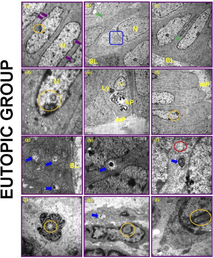 FIGURE 16