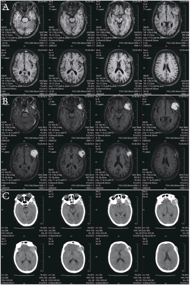 Figure 1