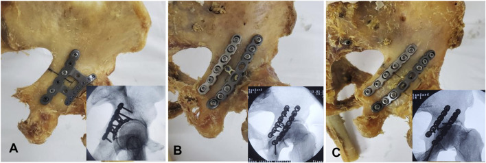 FIGURE 2