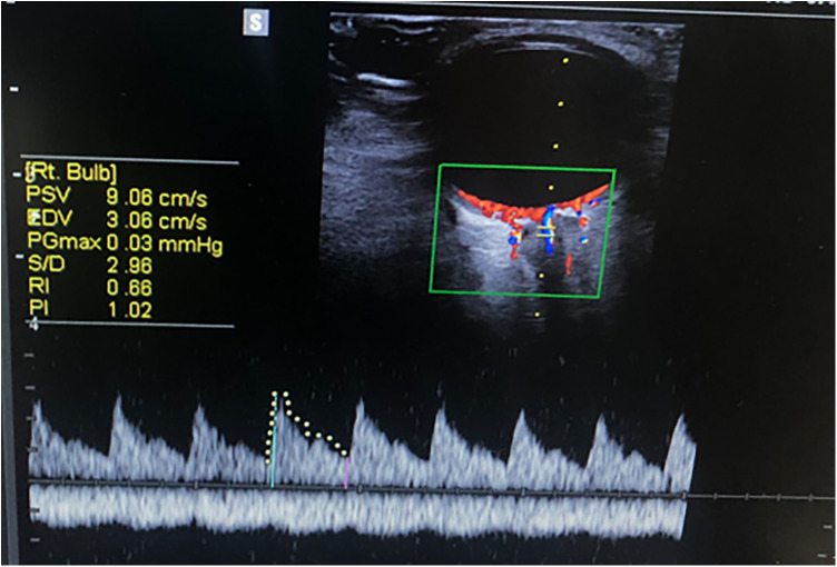 Figure 3