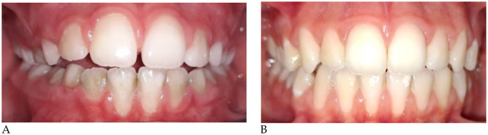 Figure 2