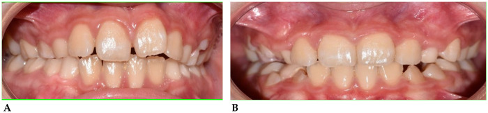 Figure 4