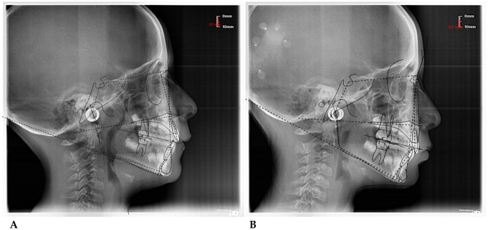 Figure 10