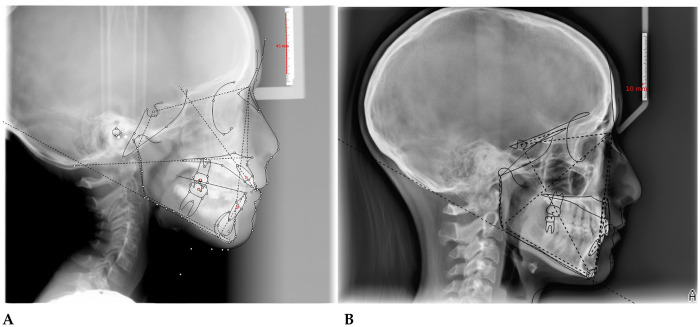 Figure 12
