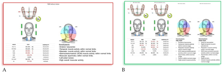 Figure 13