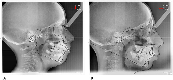 Figure 14