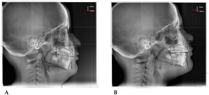 Figure 16