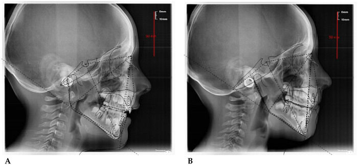 Figure 18