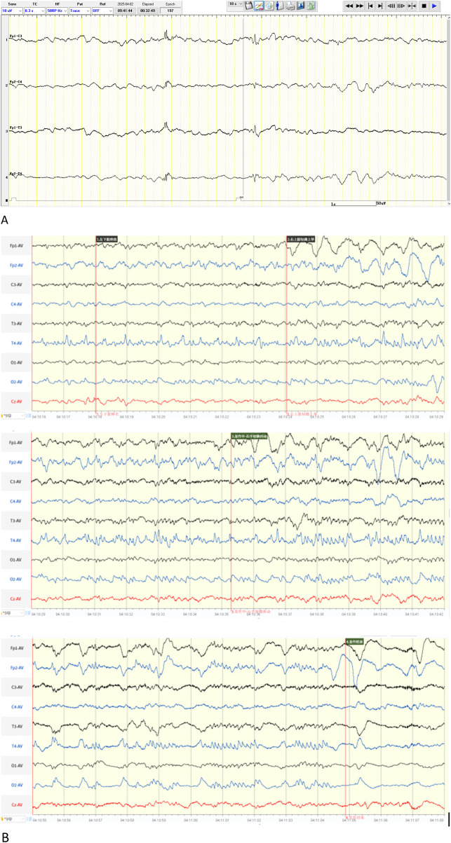 Figure 4