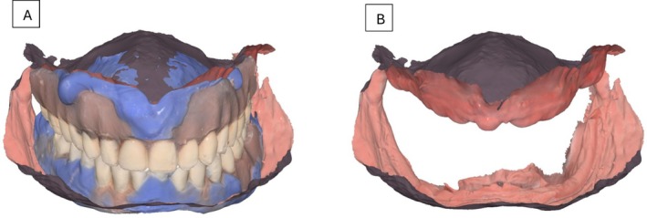 FIGURE 3