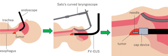 FIGURE 3