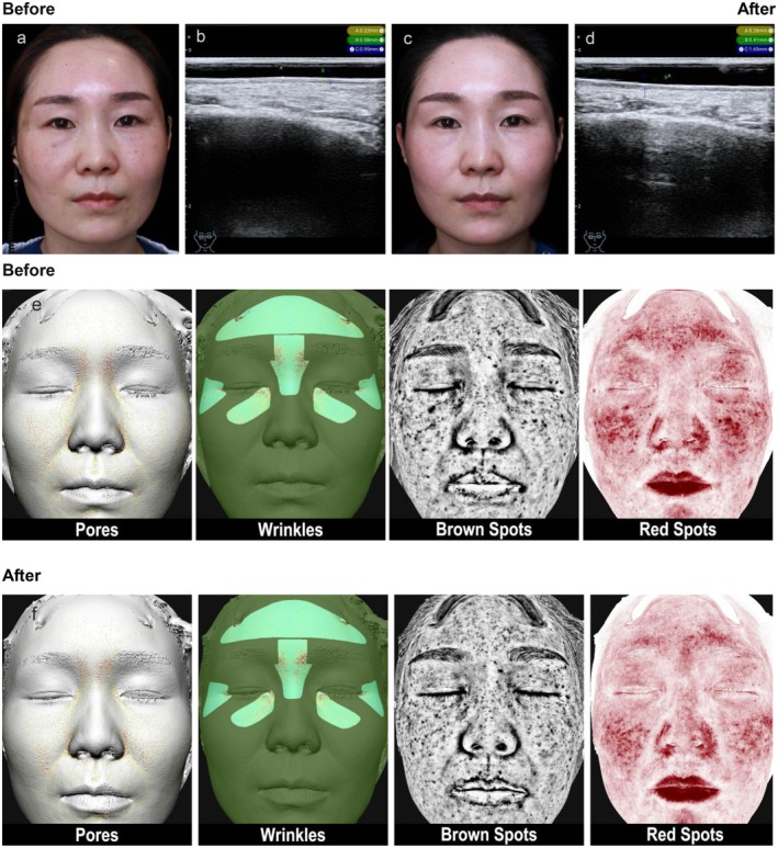 FIGURE 4