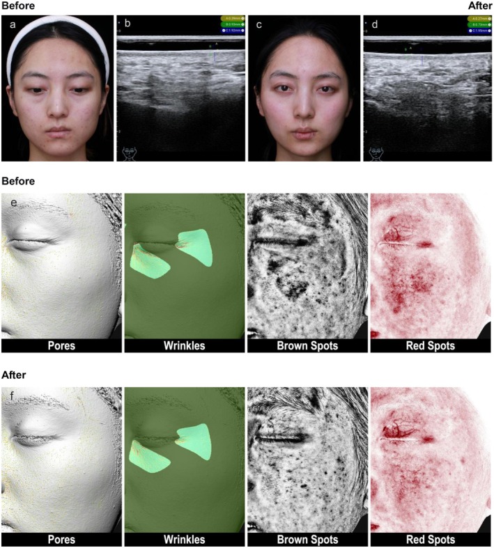 FIGURE 2