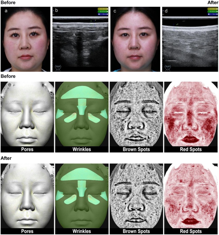 FIGURE 3