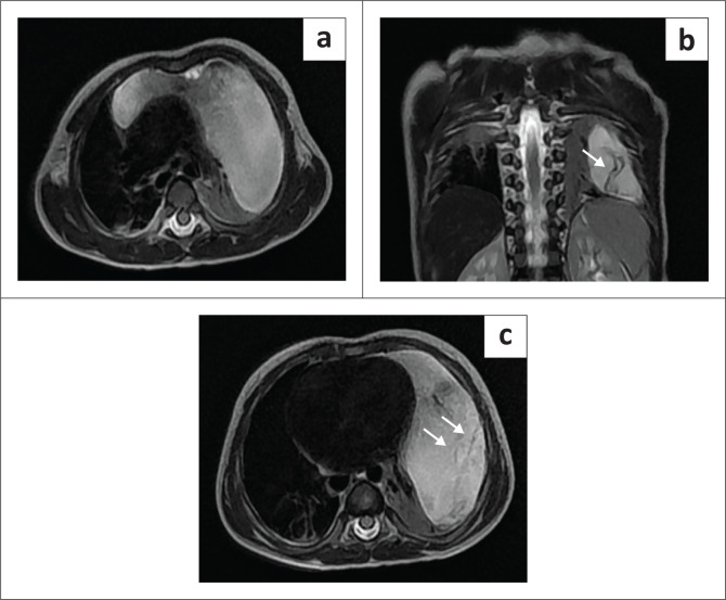 FIGURE 3