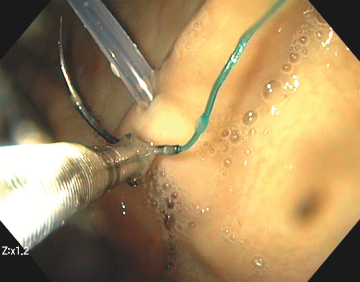 Fig. 4