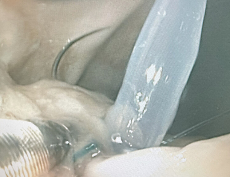 Fig. 6