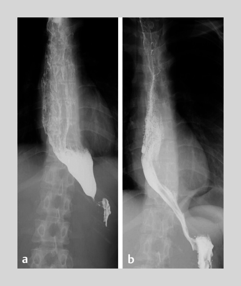Fig. 5