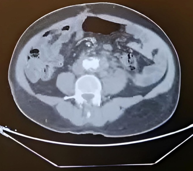 FIGURE 1